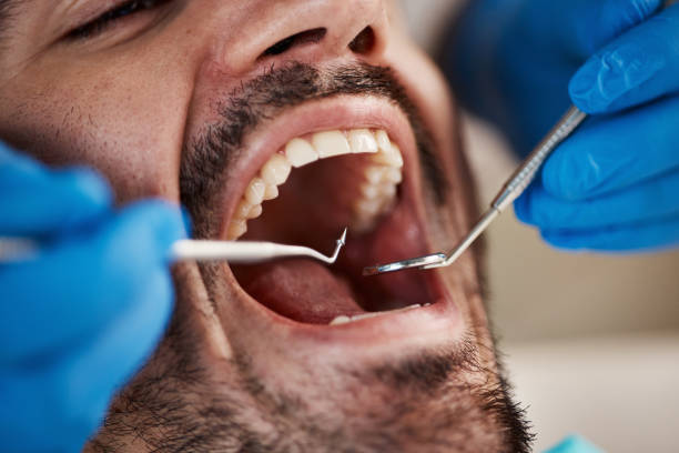 Best Emergency Treatment for Oral Infections in Meyers, CA